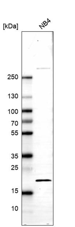 Invitrogen BTF3 Polyclonal Antibody 100 &mu;L; Unconjugated:Antibodies