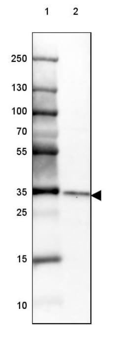 Invitrogen CHMP5 Polyclonal Antibody 100 &mu;L; Unconjugated:Antibodies,