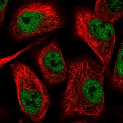 Invitrogen TIMM50 Polyclonal Antibody 100 &mu;L; Unconjugated:Antibodies,