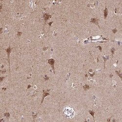 Invitrogen TIMM50 Polyclonal Antibody 100 &mu;L; Unconjugated:Antibodies,
