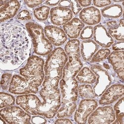 Invitrogen TIMM50 Polyclonal Antibody 100 &mu;L; Unconjugated:Antibodies,