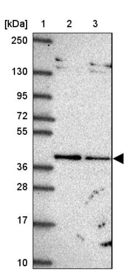 Invitrogen TIMM50 Polyclonal Antibody 100 &mu;L | Buy Online | Invitrogen&trade; | Fisher Scientific