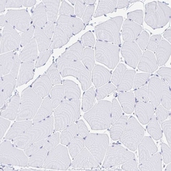 Invitrogen CPVL Polyclonal Antibody 100 &mu;L | Buy Online | Invitrogen&trade; | Fisher Scientific