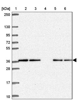 Invitrogen CAMLG Polyclonal Antibody 100 &mu;L; Unconjugated:Antibodies,