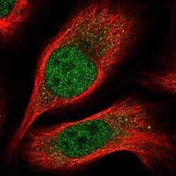 Invitrogen CBX7 Polyclonal Antibody 100 &mu;L; Unconjugated:Antibodies,