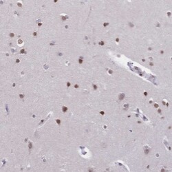 Invitrogen CBX7 Polyclonal Antibody 100 &mu;L; Unconjugated:Antibodies,