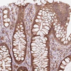 Invitrogen GPSN2 Polyclonal Antibody 100 &mu;L; Unconjugated:Antibodies,