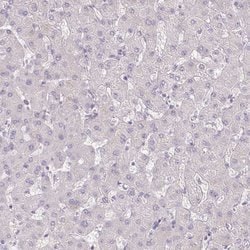 Invitrogen C17orf96 Polyclonal Antibody 100 &mu;L | Buy Online | Invitrogen&trade; | Fisher Scientific