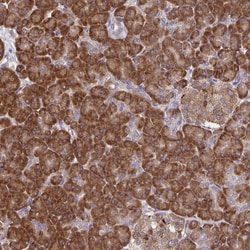 Invitrogen RPS7 Polyclonal Antibody 100 &mu;L; Unconjugated:Antibodies,