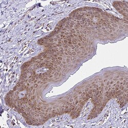 Invitrogen RPS7 Polyclonal Antibody 100 &mu;L; Unconjugated:Antibodies,