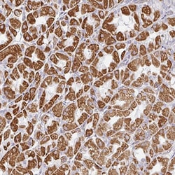 Invitrogen ZNF526 Polyclonal Antibody 100 &mu;L; Unconjugated:Antibodies,