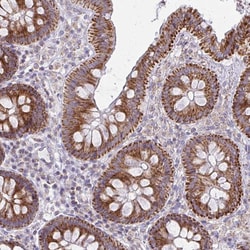 Invitrogen MRPL19 Polyclonal Antibody 100 &mu;L; Unconjugated:Antibodies,