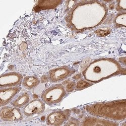 Invitrogen ZNF33A Polyclonal Antibody 100 μL; Unconjugated:Antibodies,