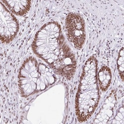 Invitrogen FAM122A Polyclonal Antibody 100 &mu;L; Unconjugated:Antibodies,