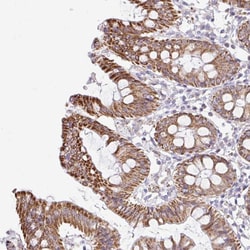 Invitrogen NT5C1B Polyclonal Antibody 100 &mu;L; Unconjugated:Antibodies,