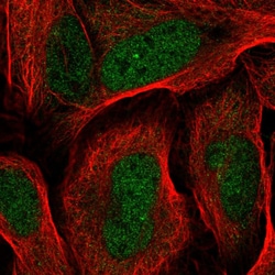 Invitrogen RDH14 Polyclonal Antibody 100 &mu;L | Buy Online | Invitrogen&trade; | Fisher Scientific