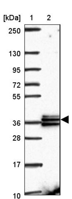 Invitrogen RDH14 Polyclonal Antibody 100 &mu;L | Buy Online | Invitrogen&trade; | Fisher Scientific