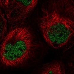 Invitrogen PPP1R10 Polyclonal Antibody 100 &mu;L; Unconjugated:Antibodies,