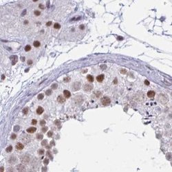 Invitrogen PPP1R10 Polyclonal Antibody 100 &mu;L; Unconjugated:Antibodies,