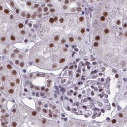 Invitrogen PPP1R10 Polyclonal Antibody 100 &mu;L; Unconjugated:Antibodies,