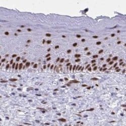Invitrogen PPP1R10 Polyclonal Antibody 100 &mu;L; Unconjugated:Antibodies,