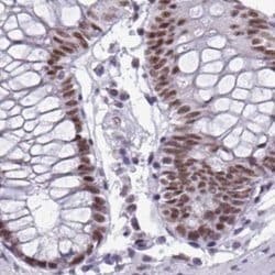 Invitrogen PPP1R10 Polyclonal Antibody 100 &mu;L; Unconjugated:Antibodies,