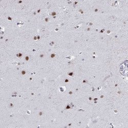 Invitrogen PPP1R10 Polyclonal Antibody 100 &mu;L; Unconjugated:Antibodies,
