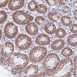 Invitrogen OR51M1 Polyclonal Antibody 100 &mu;L; Unconjugated:Antibodies,