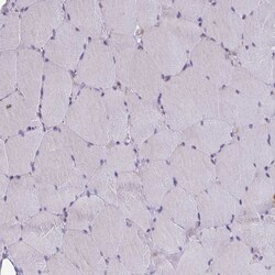 Invitrogen EPB41L1 Polyclonal Antibody 100 &mu;L; Unconjugated:Antibodies,