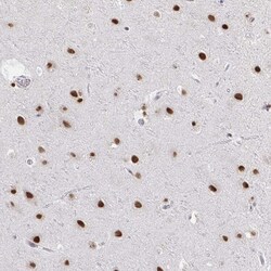 Invitrogen hnRNP DL Polyclonal Antibody 100 &mu;L; Unconjugated:Antibodies,