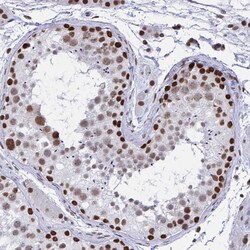 Invitrogen hnRNP DL Polyclonal Antibody 100 &mu;L; Unconjugated:Antibodies,