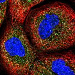 Invitrogen CPTP Polyclonal Antibody 100 &mu;L; Unconjugated:Antibodies,