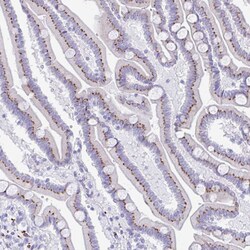 Invitrogen CPTP Polyclonal Antibody 100 &mu;L; Unconjugated:Antibodies,