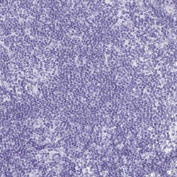 Invitrogen CPTP Polyclonal Antibody 100 &mu;L; Unconjugated:Antibodies,