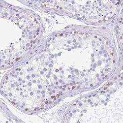 Invitrogen CPTP Polyclonal Antibody 100 &mu;L; Unconjugated:Antibodies,
