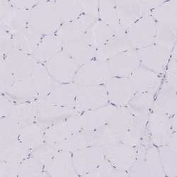 Invitrogen HSD17B3 Polyclonal Antibody 100 &mu;L | Buy Online | Invitrogen&trade; | Fisher Scientific
