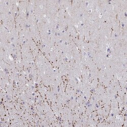 ARPP19 Polyclonal Antibody:Antibodies, Polyclonal