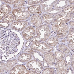Invitrogen PYCR2 Polyclonal Antibody 100 &mu;L; Unconjugated:Antibodies,