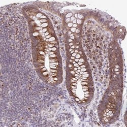 Invitrogen PYCR2 Polyclonal Antibody 100 &mu;L; Unconjugated:Antibodies,
