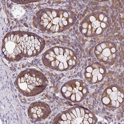 Invitrogen GFPT2 Polyclonal Antibody 100 &mu;L; Unconjugated:Antibodies,