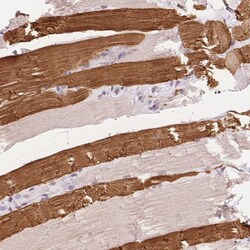 Invitrogen TNNT3 Polyclonal Antibody 100 &mu;L; Unconjugated:Antibodies,