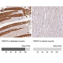 Invitrogen TNNT3 Polyclonal Antibody 100 &mu;L; Unconjugated:Antibodies,