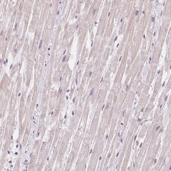 Invitrogen TNNT3 Polyclonal Antibody 100 &mu;L; Unconjugated:Antibodies,