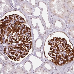 Invitrogen SRSF7 Polyclonal Antibody 100 &mu;L; Unconjugated:Antibodies,