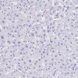 Invitrogen Ankyrin 1 Polyclonal Antibody 100 &mu;L | Buy Online | Invitrogen&trade; | Fisher Scientific