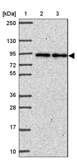 Invitrogen Ankyrin 1 Polyclonal Antibody 100 &mu;L | Buy Online | Invitrogen&trade; | Fisher Scientific