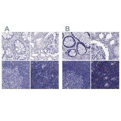Invitrogen PSMB11 Polyclonal Antibody 100 &mu;L; Unconjugated:Antibodies,