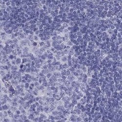 Invitrogen PSMB11 Polyclonal Antibody 100 &mu;L; Unconjugated:Antibodies,