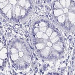 Invitrogen PSMB11 Polyclonal Antibody 100 &mu;L; Unconjugated:Antibodies,