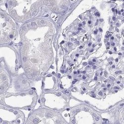Invitrogen PSMB11 Polyclonal Antibody 100 &mu;L; Unconjugated:Antibodies,